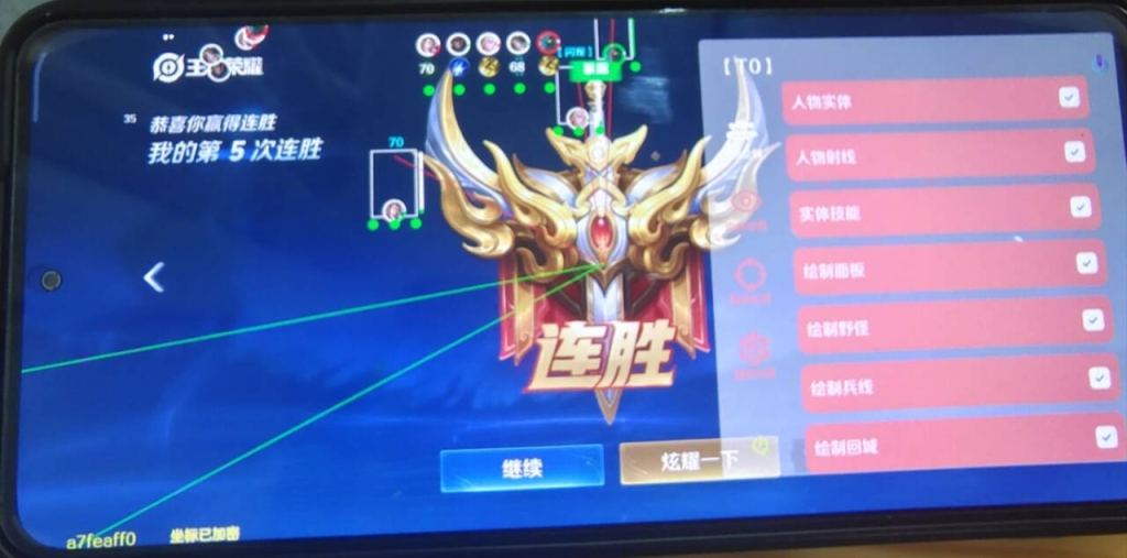 王者荣耀辅助发卡网使用技巧大公开：让你游戏事半功倍